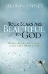 Your Scars Are Beautiful to God: Finding Peace And Purpose in the Hurts of Your Past