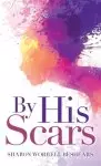 By His Scars