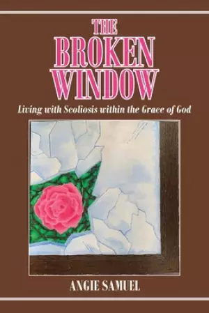 The Broken Window: Living with Scoliosis within the Grace of God