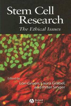 Stem Cell Research: The Ethical Issues