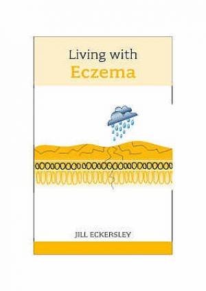 Living With Eczema