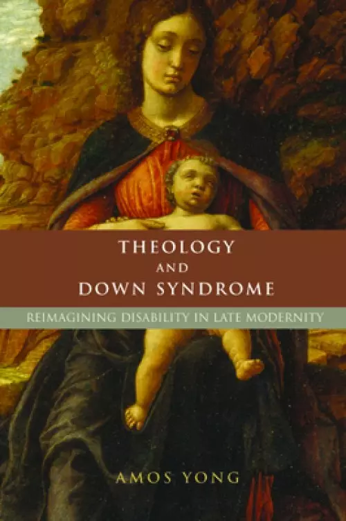 Theology and Down Syndrome: Reimagining Disability in Late Modernity