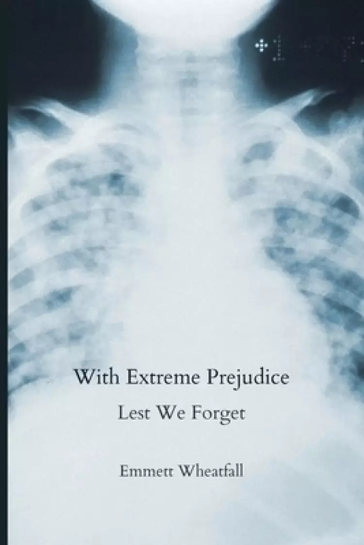 With Extreme Prejudice: Lest We Forget