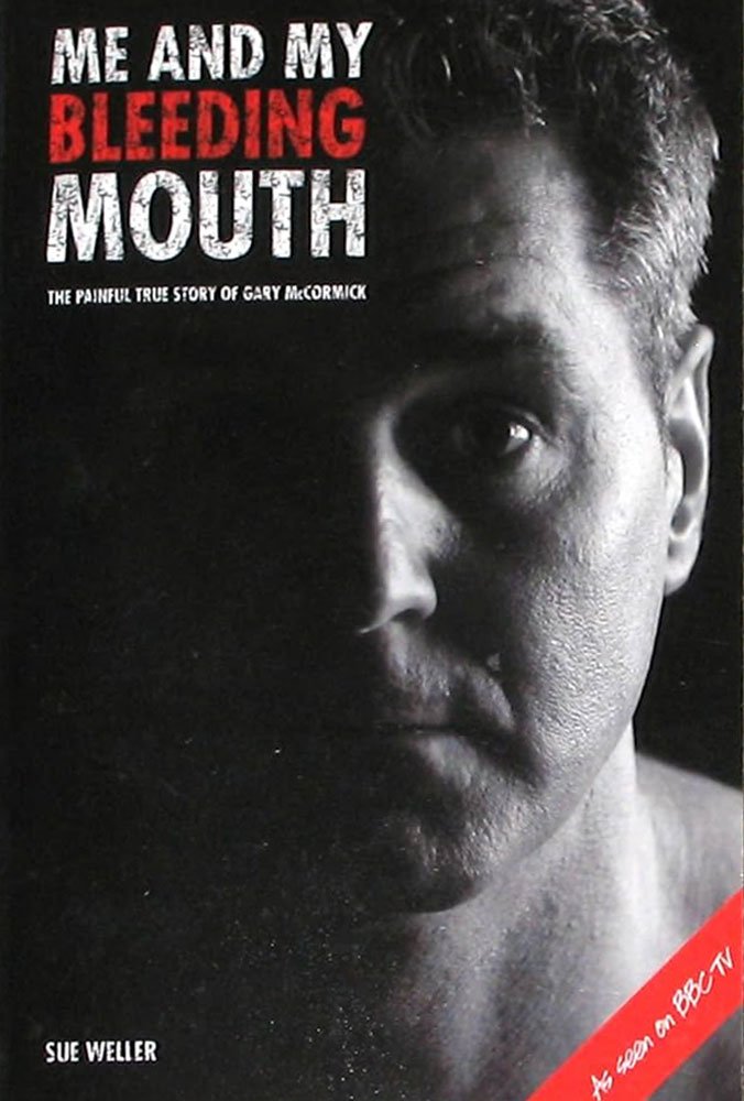 Me and My Bleeding Mouth The Painful Story of Gary Mc Cormick