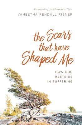 The Scars That Have Shaped Me How God Meets Us in Suffering